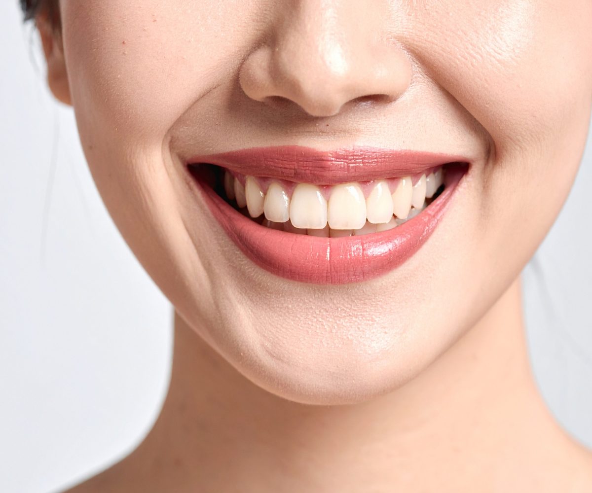 A close photograph of a smile